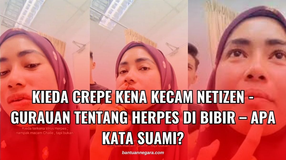 KIEDA CREPE KENA KECAM NETIZEN - GURAUAN TENTANG HERPES DI BIBIR – APA KATA SUAMI?